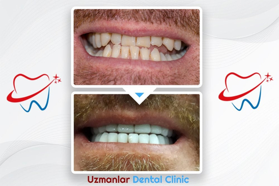 Slider image (7) Uzmanlar Dental Clinic